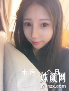 广州艺美李闯综合隆鼻恢效果图