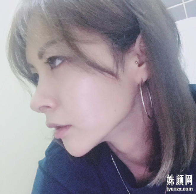 悦美好医医疗美容门诊部隆鼻效果图