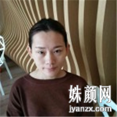 北京叶美人医疗美容诊所张伟自体脂肪填充术前图